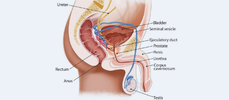 kidney stone disease 1